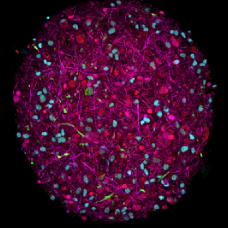 Scientists unveil plan to create biocomputers powered by human brain cells