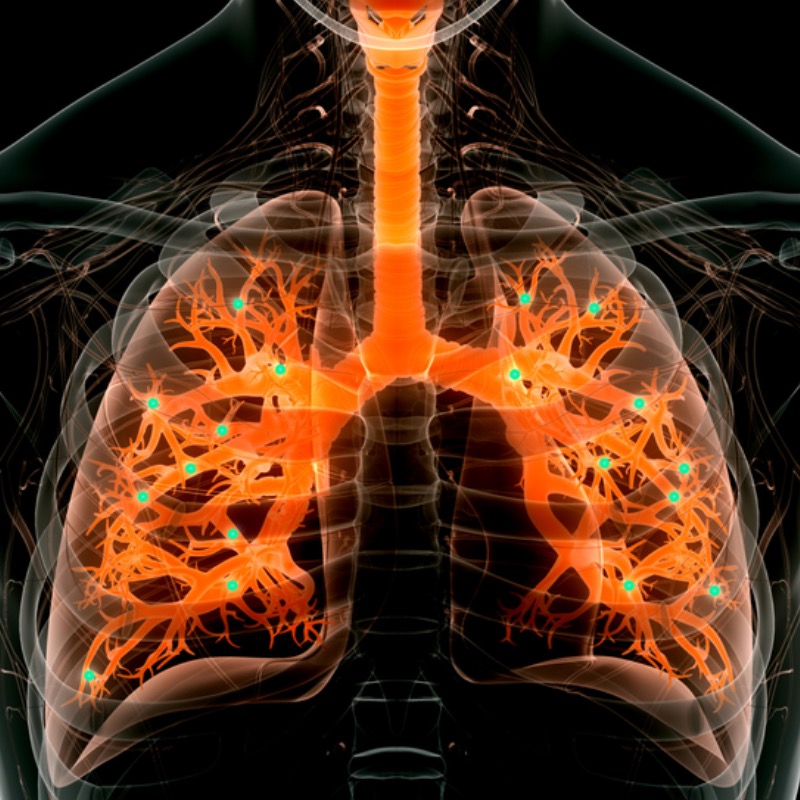 New RNA nanoparticles can perform gene editing in the lungs to treat lung diseases