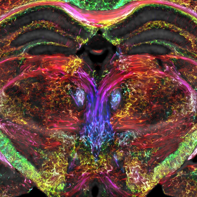 Brain Images Just Got 64 Million Times Sharper