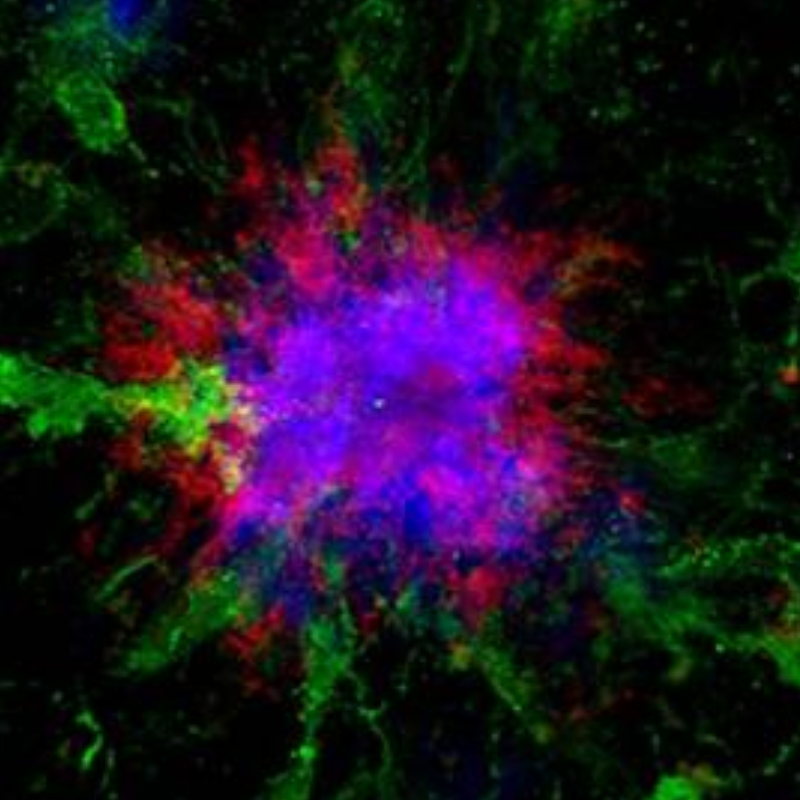 Mice on a time-restricted feeding schedule had better memory and less accumulation of amyloid proteins in the brain compared to controls