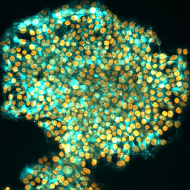 Scientists find way to wipe a cell’s memory to better reprogram it as an embryonic stem cell