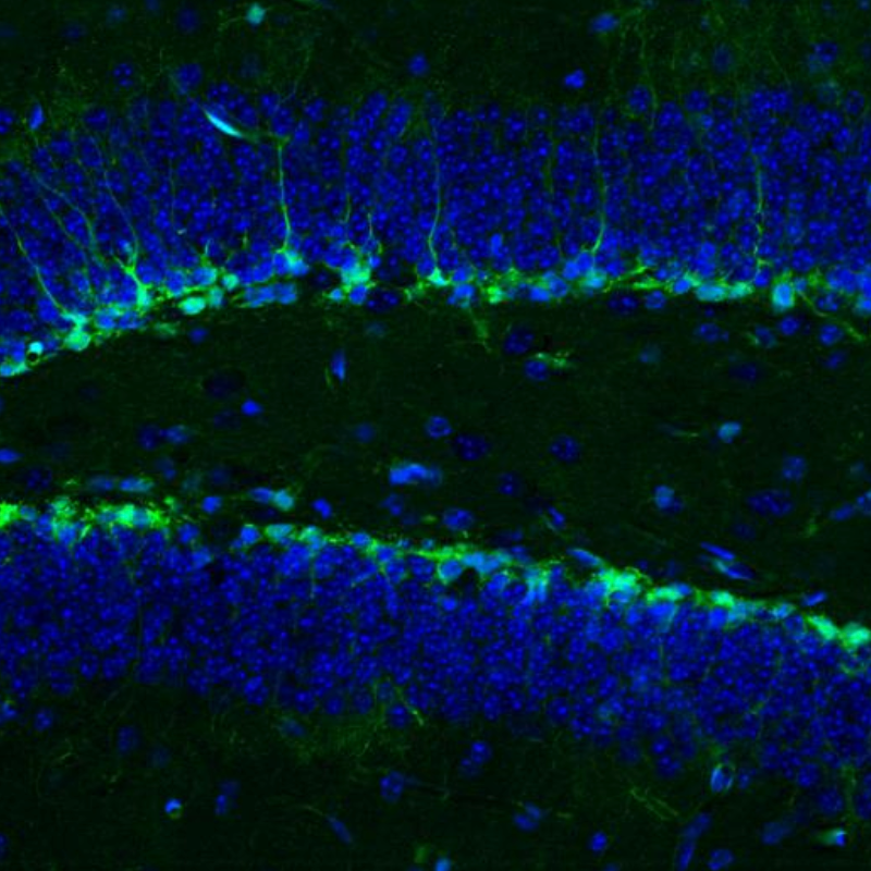 Can't exercise? A protein from blood platelets may rejuvenate your neurons