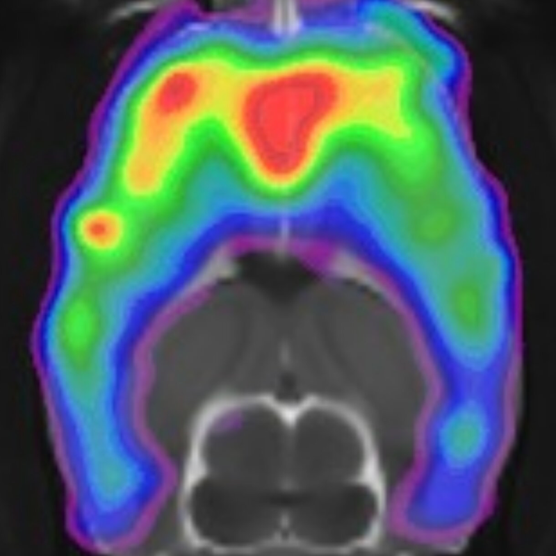 Microdosing psilocybin mushrooms as a therapeutic tool