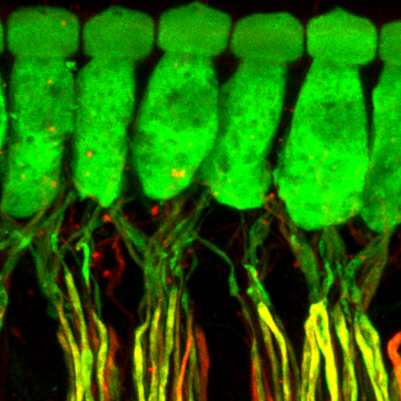 New gene therapy restores natural hearing for deafness at birth