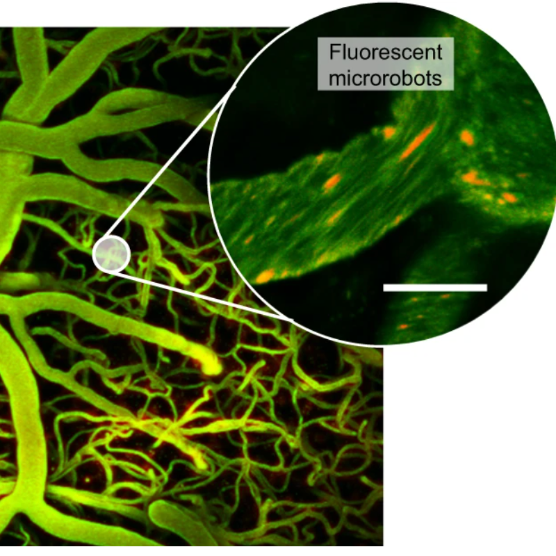 Ultrasound microrobots guide medications to treat brain tumors, other conditions