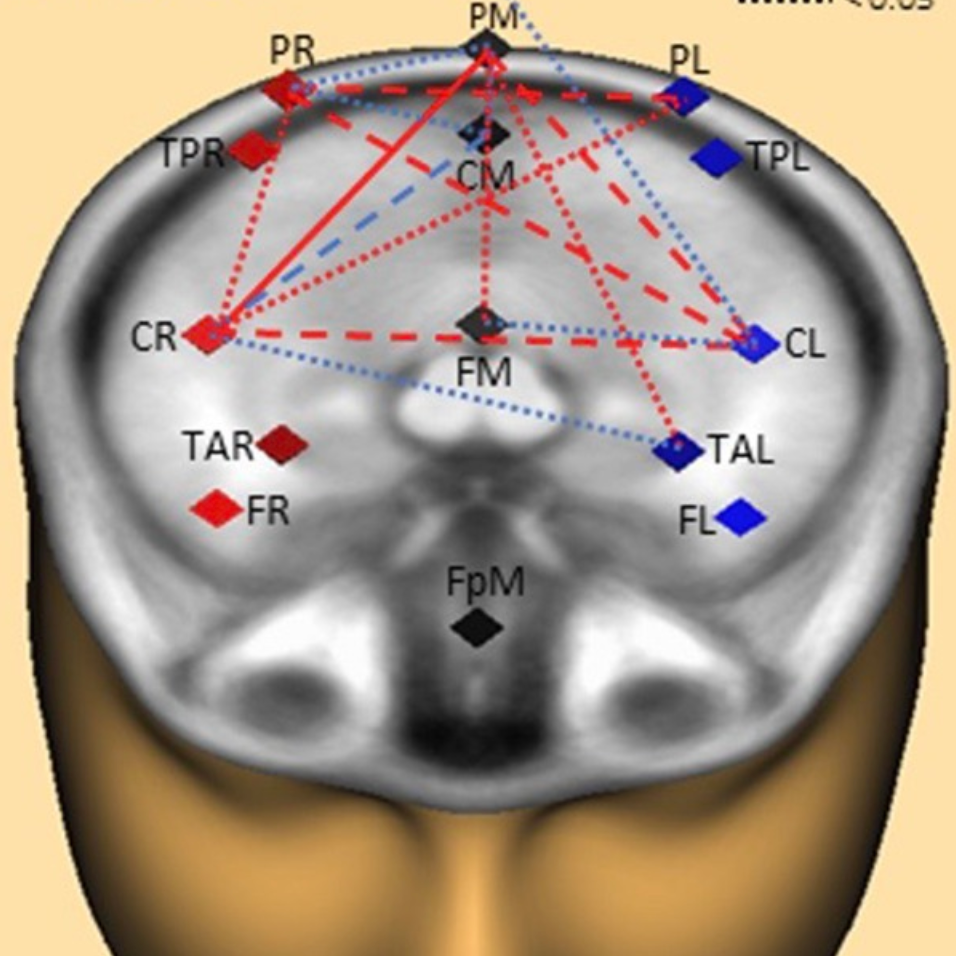 Writing by hand leads to higher brain connectivity than typing on a keyboard
