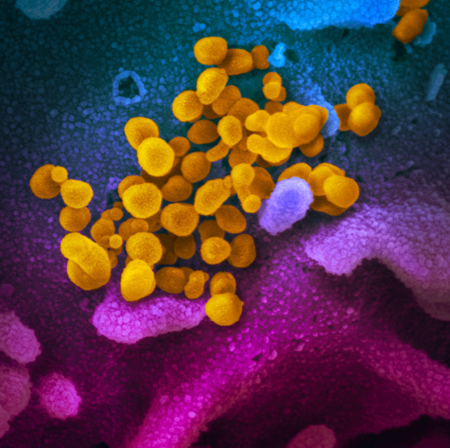 Novel compound protects against infection by virus that causes COVID-19,  preliminary studies show