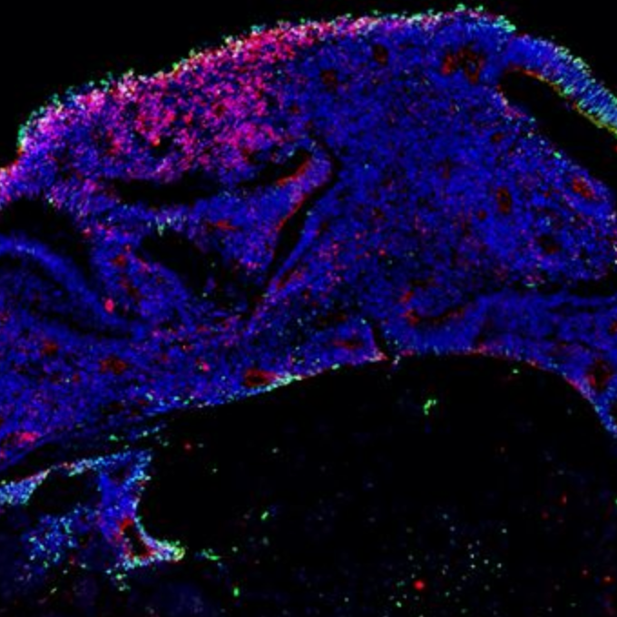 Game-changing organoid model to study human cerebellar development and disease