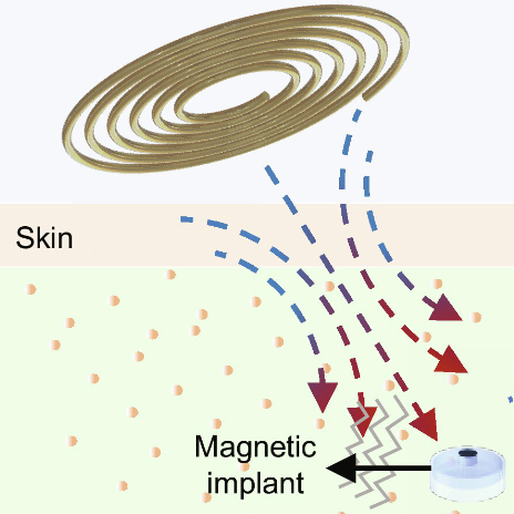 Tiny magnetic sensor enables wireless health monitoring