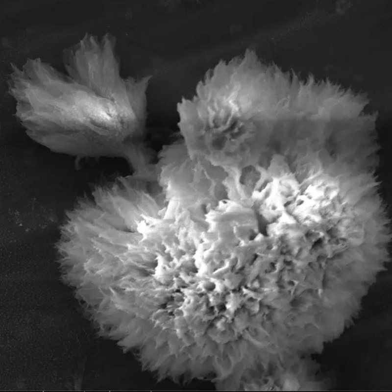 Machine-learning algorithm tracks dementia-related protein clumping in real time