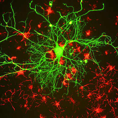 Scientists turn on new neuron production in mice brains