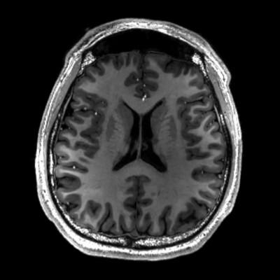 GPT-4 performs as well as human radiologists