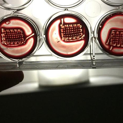 Personalized, blood-based, 3D-printed implants for regenerative medicine