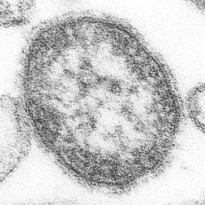 Scientist successfully treats her own cancer with viruses