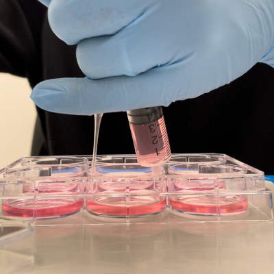 Kidney and nerve cells learn and form memories like neurons