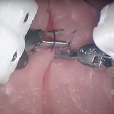 Surgical robot trained with videos performs as well as human surgeons
