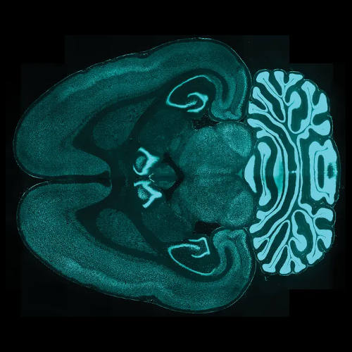 New method labels proteins in large tissue samples with high speed