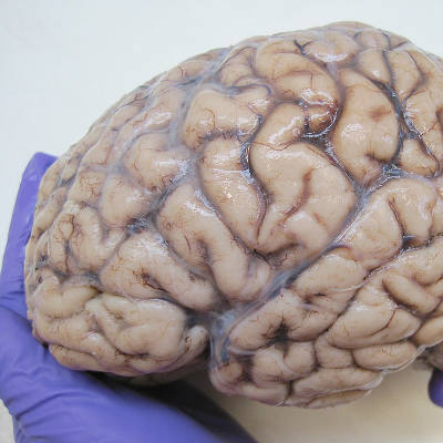 Scientists create first map of energy structures in the human brain