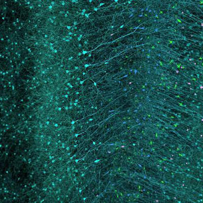 Open Brain Institute launches digital brain research program