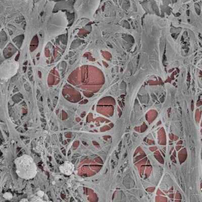 A new kind of computer powered by human brain cells