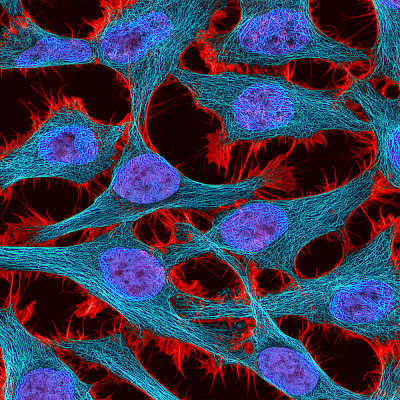 Gene therapy advances with precise control