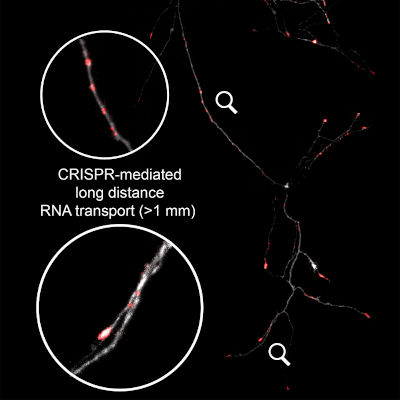 New technology helps repair damaged neurons with RNA
