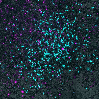 Bacteria hide viruses to fight cancer