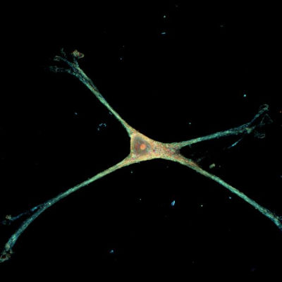 Nanotech platform allows scientists to study star-shaped brain cells in their natural form