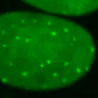 New sensor allows real-time view of DNA repair