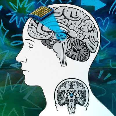 New tool may help solve consciousness puzzle