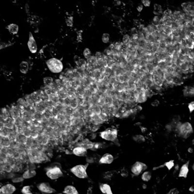 New tool acts as cellular tape recorder for biological processes