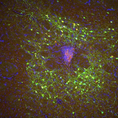 Gene therapy advance enables noninvasive brain monitoring in monkeys