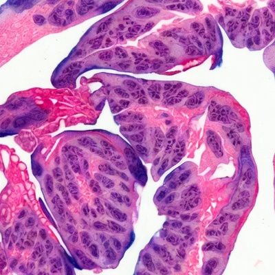 Researchers develop method to grow implanted liver tissue on demand